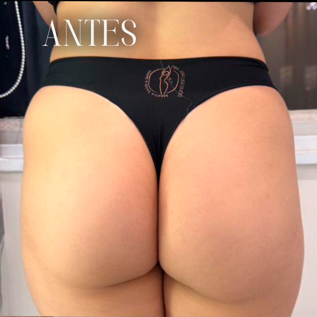 Resultado antes e depois 3